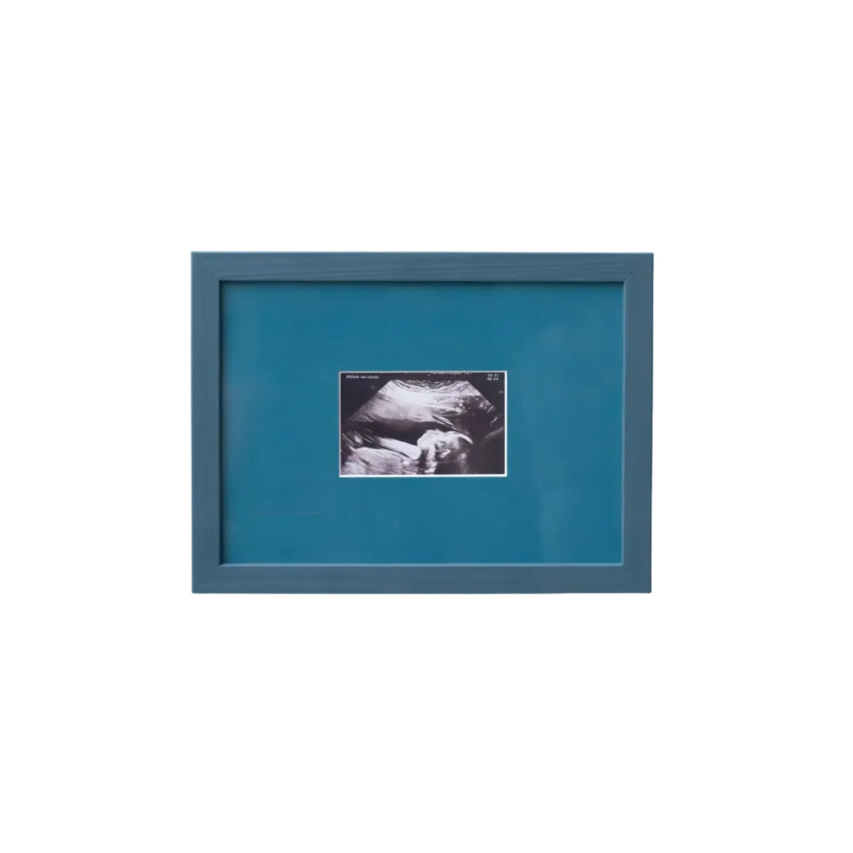 An A5 petrol blue frame from Late afternoon with a blue a5 Instax mini mount of an ultrasounds scan