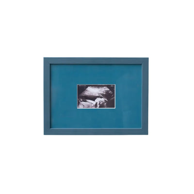An A5 petrol blue frame from Late afternoon with a blue a5 Instax mini mount of an ultrasounds scan