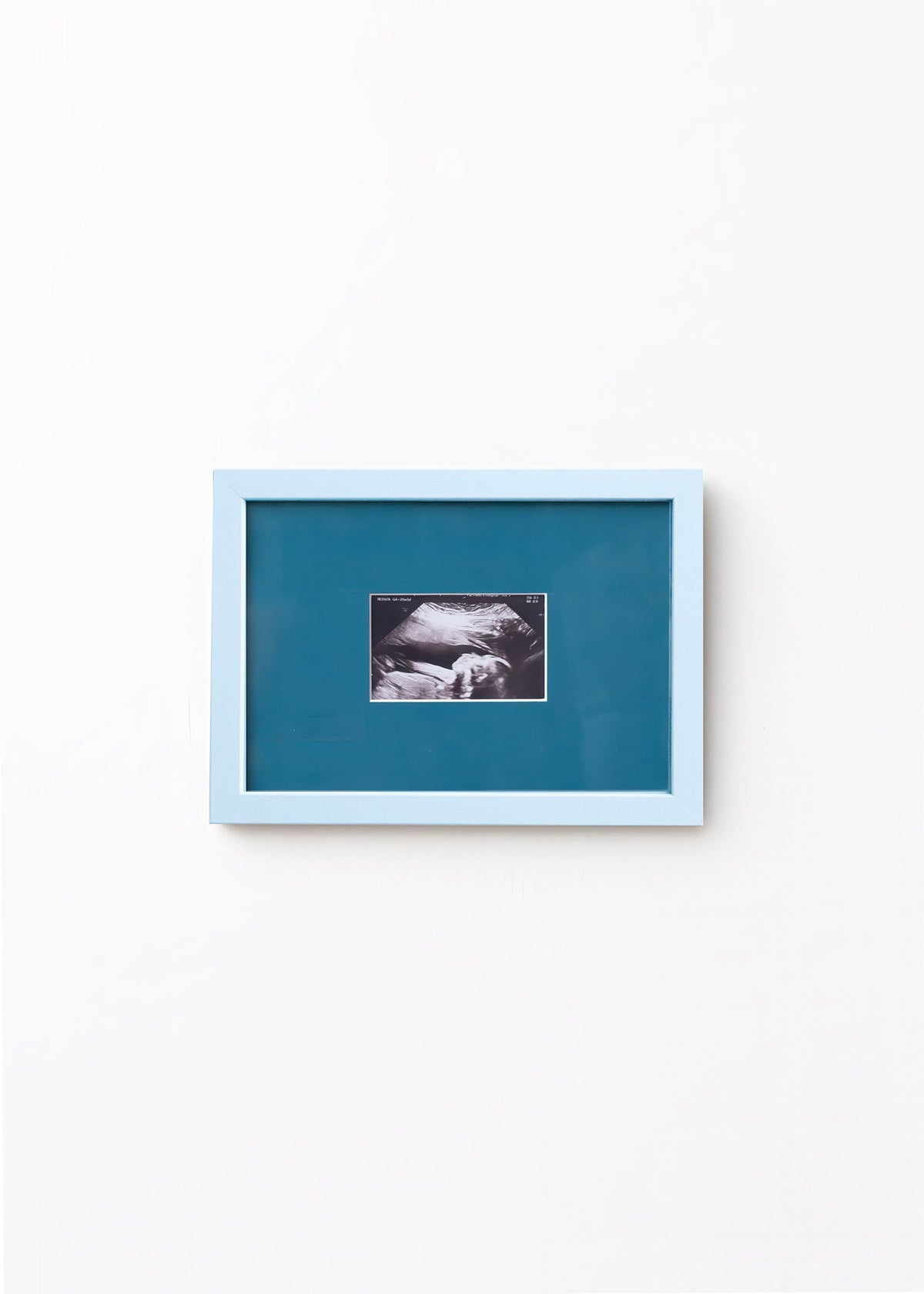 A square framed art print featuring a black and white ultrasound photo of a baby, set against a teal-blue background with a light blue frame, mounted on a plain white wall.